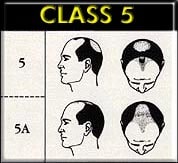 class5