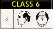 class6