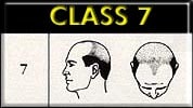 class7